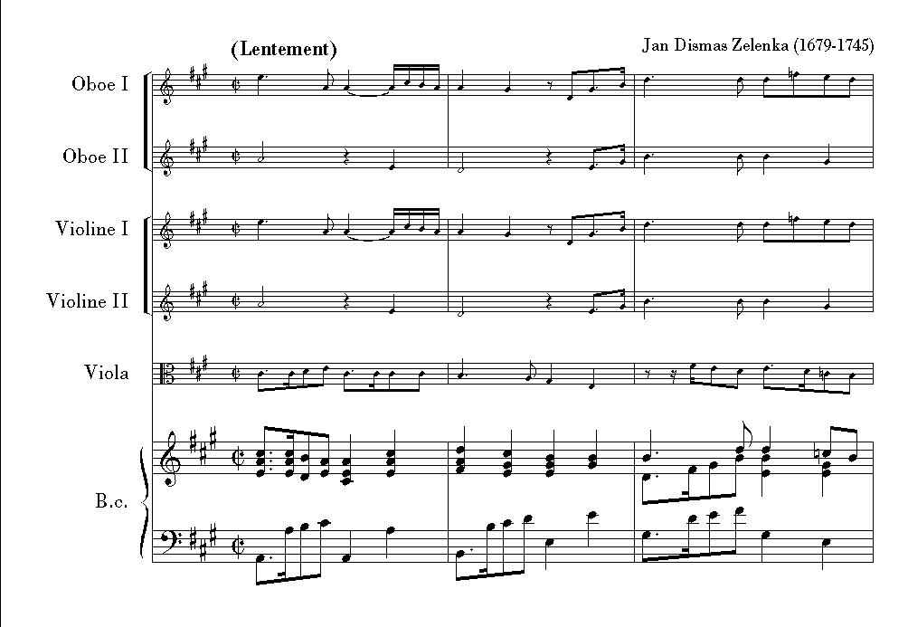 J.D. Zelenka: Hipocondrie fr<br>2 Oboen, Fagott, Streicher+BC - Partitur